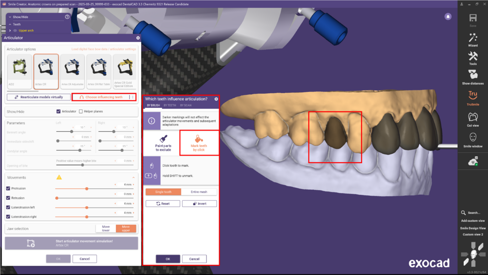 Articulator 3.3 5.png