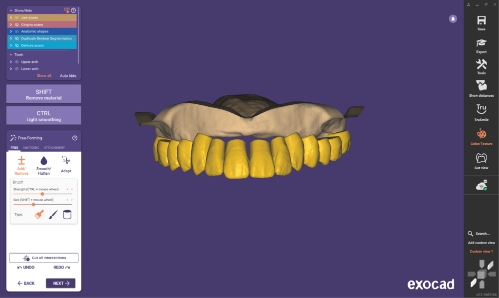 Duplicate denture3.3-09.png