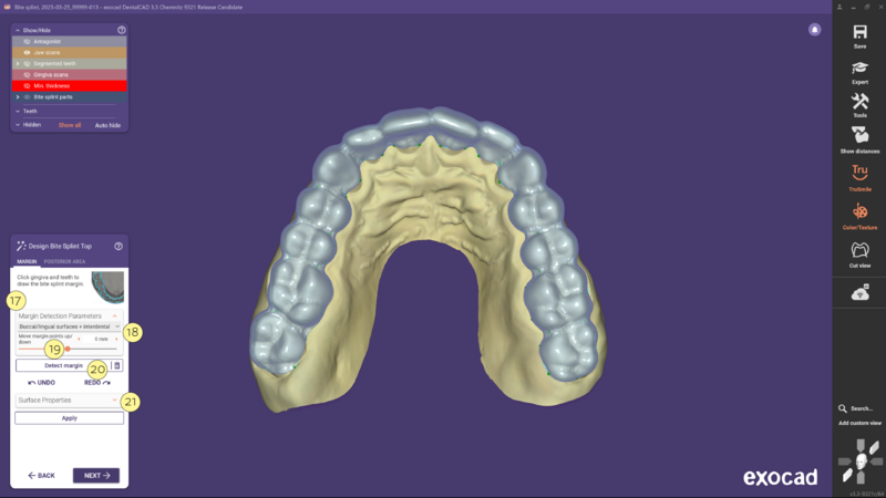 File:Bitesplint 3.3 1-03.png