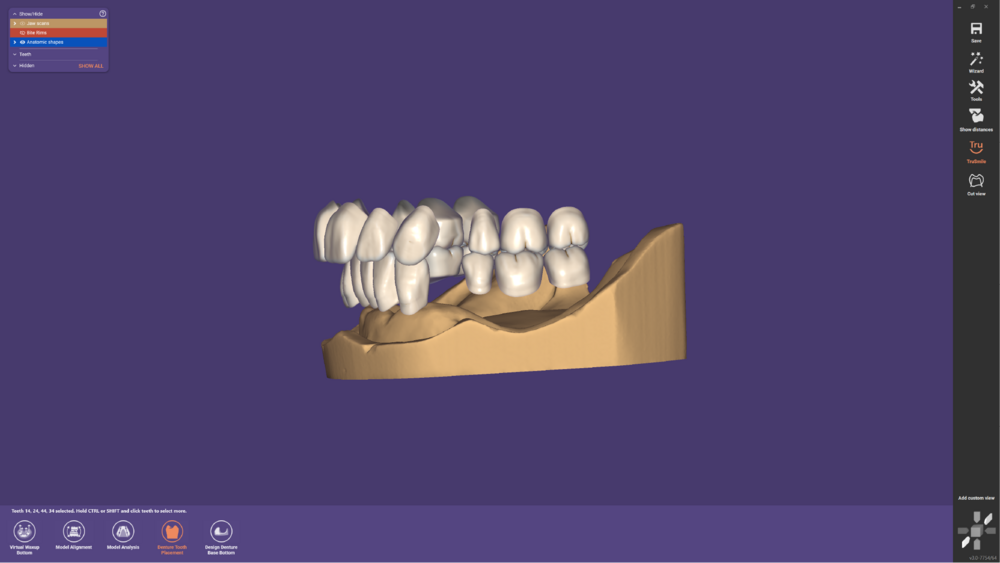 Denture remove teeth4-07.png