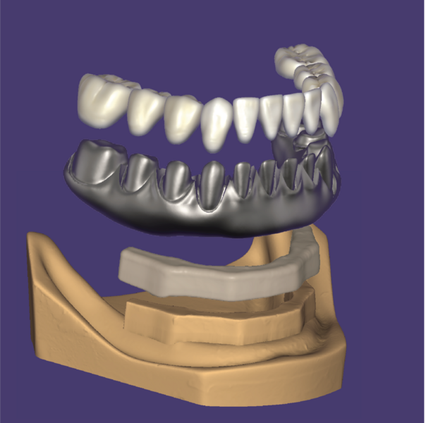File:RP4-02.png
