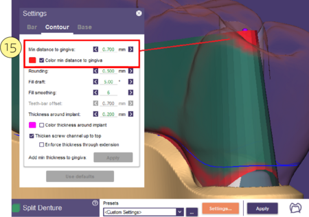 Split bar partial-25.png