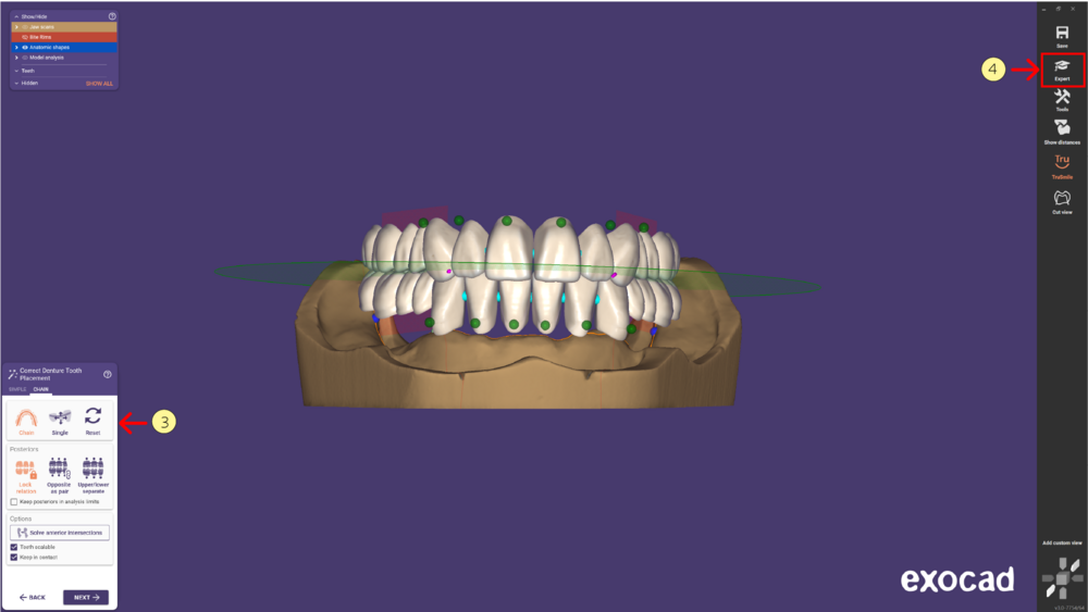 Denture remove teeth4-09 3.1.png