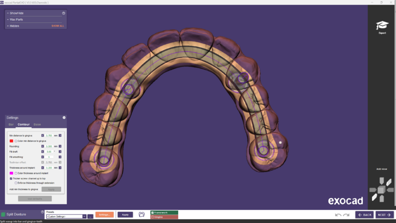 File:Split bar partial-13.png