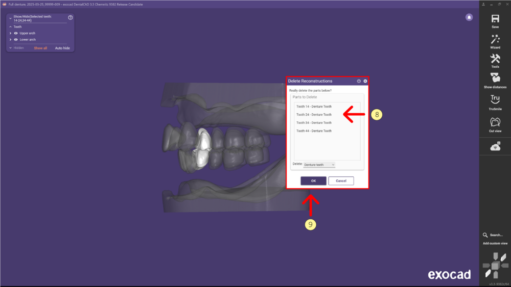 Denture remove teeth4-06 3.3.png
