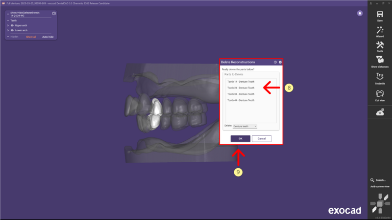 File:Denture remove teeth4-06 3.3.png
